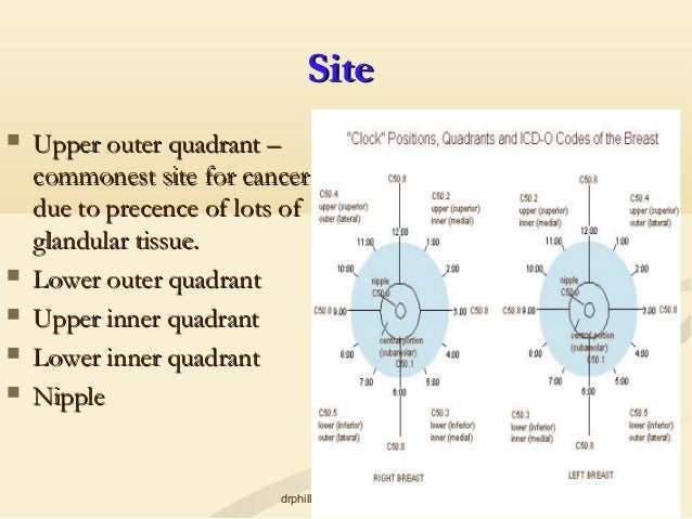 breast cancer quadrant incidence Man gloryhole pics